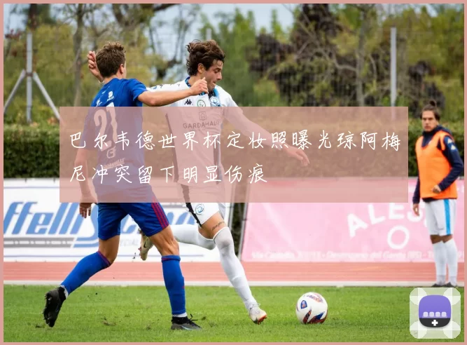 巴尔韦德世界杯定妆照曝光琼阿梅尼冲突留下明显伤痕